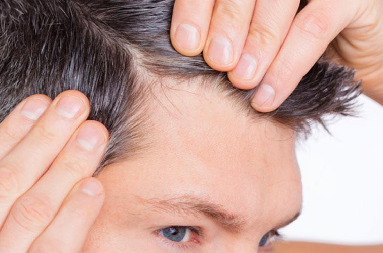 Hair loss