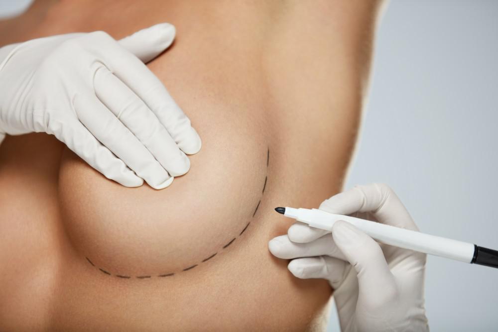 Breast