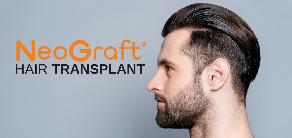 Hair Transplant