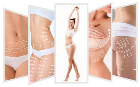 Orange County Liposuction