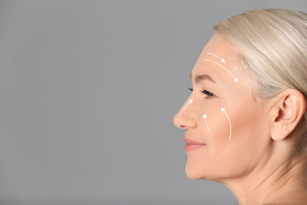 A Facelift