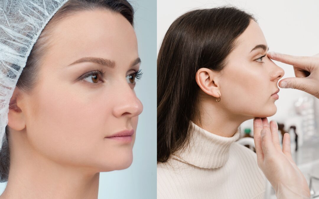 Difference Between Rhinoplasty and Septoplasty