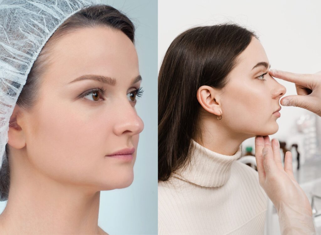 Rhinoplasty and Septoplasty