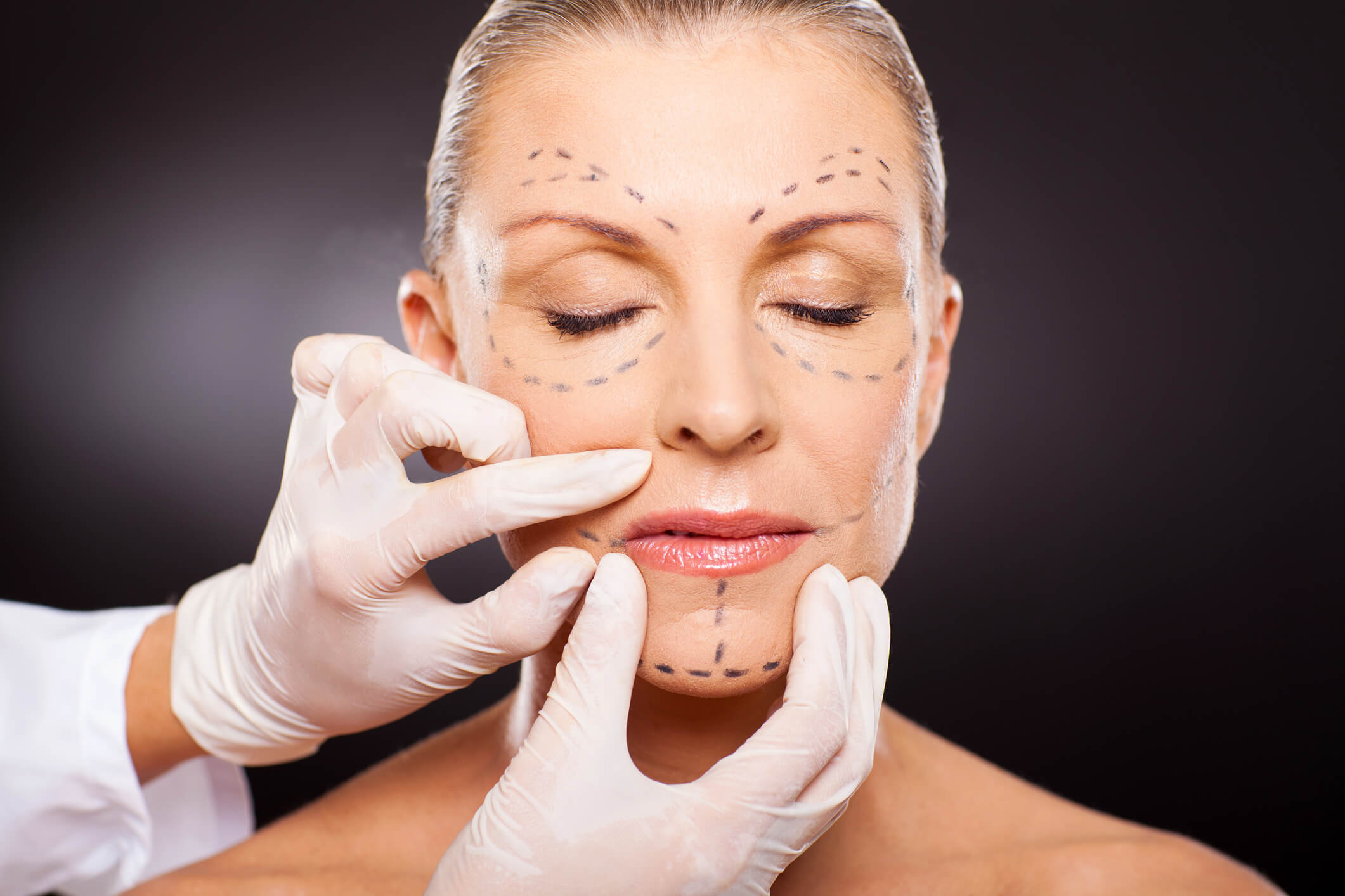 What Insurance Covers Cosmetic Surgery In Orange County