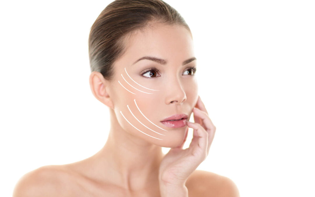 Benefits of a Facelift in Orange County, CA