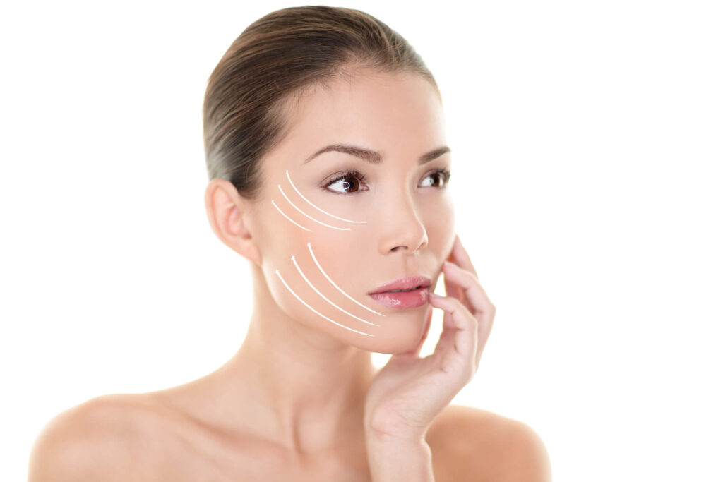 Benefits of a Facelift in Orange County