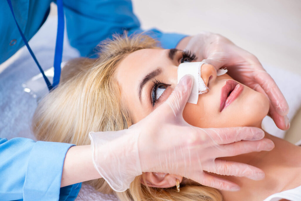 Rhinoplasty Recovery