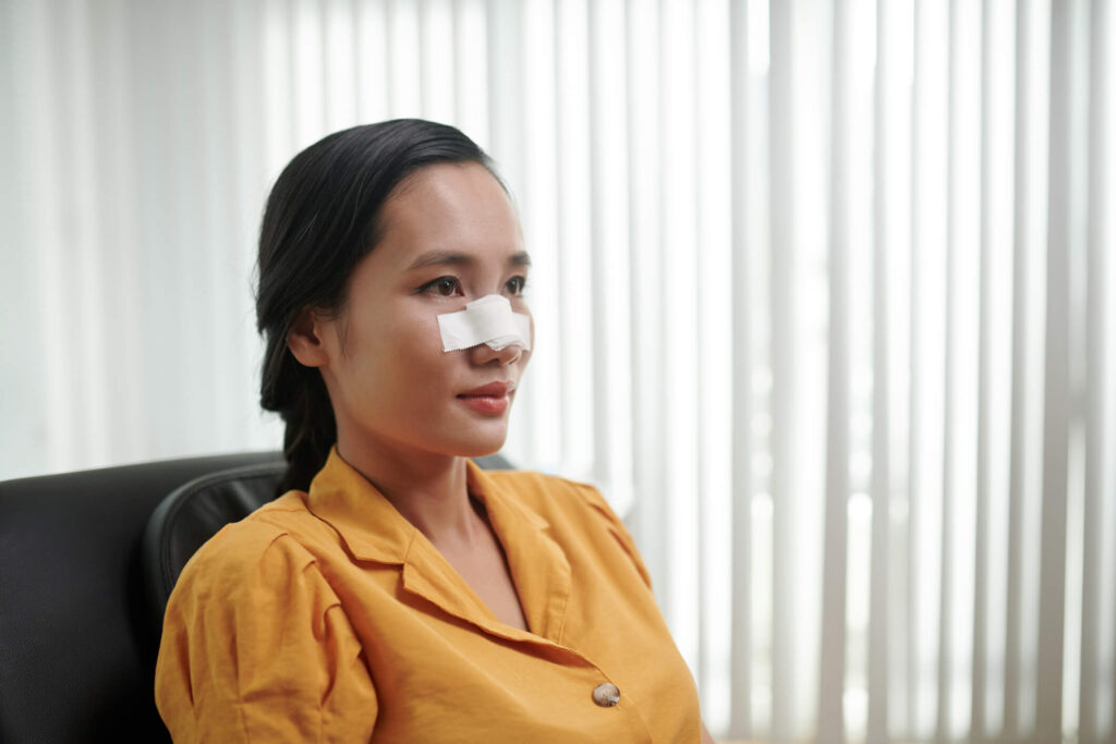 Rhinoplasty Swelling Stages