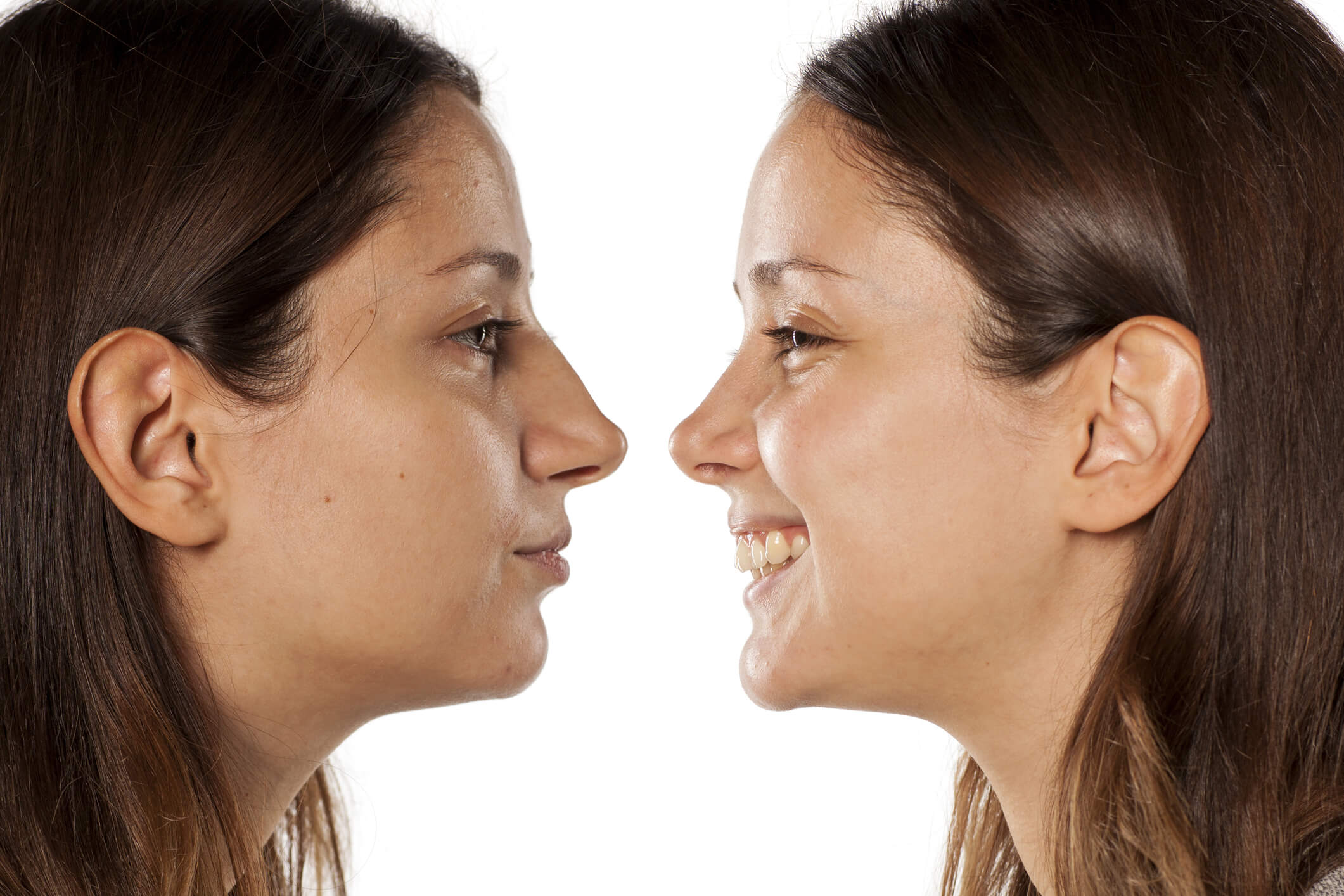 Types of Rhinoplasty