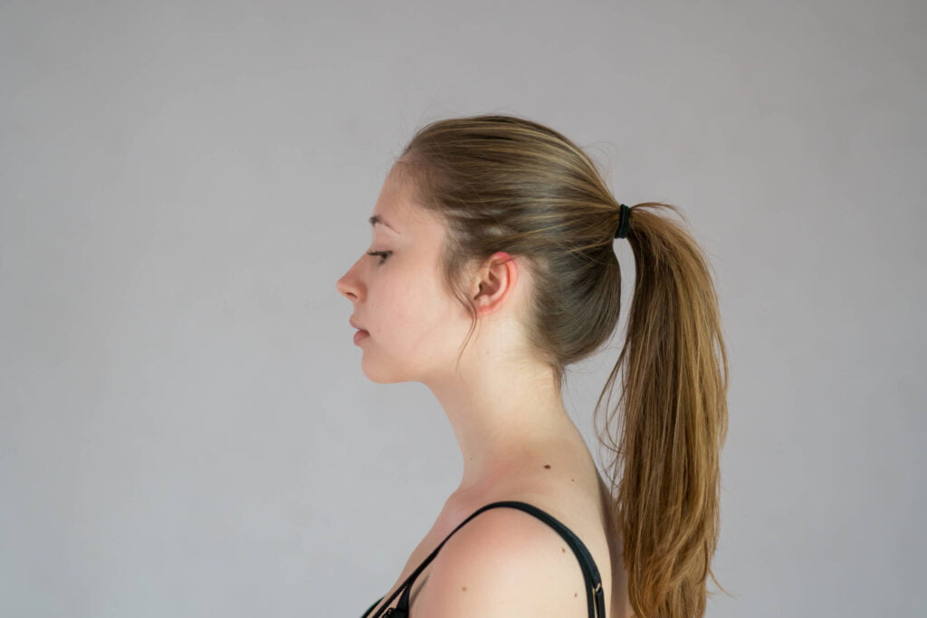 Teenage-Rhinoplasty-Women