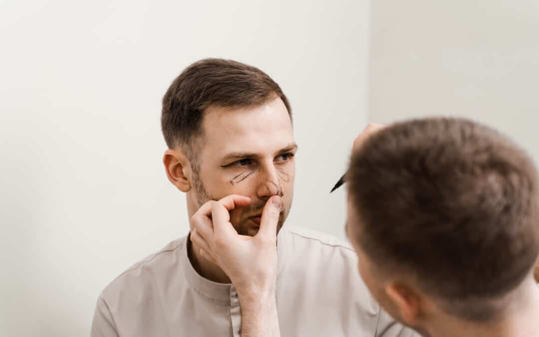 Male rhinoplasty by Dr. George Brennan in Orange County, California for enhanced facial features.