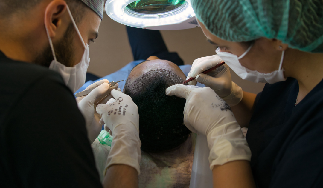 Hair Transplant California: How to Choose a Trusted Clinic for Long-Term Success