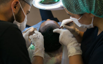 Hair Transplant California: How to Choose a Trusted Clinic for Long-Term Success