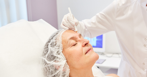 Facelift surgical planning emphasizing precision and natural results by an experienced California facelift surgeon