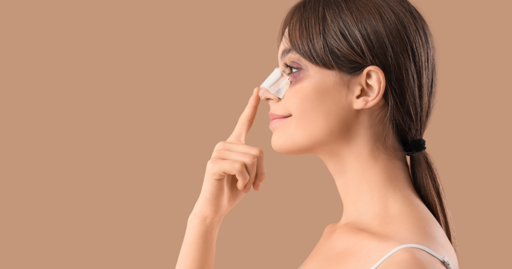 Post rhinoplasty recovery showing natural nose refinement for a Newport Beach rhinoplasty patient