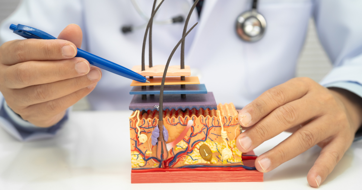 Hair follicle anatomy model explained by cosmetic surgeon during hair transplant and hair restoration consultation in Newport Beach