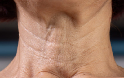 Neck Lift Surgery Newport Beach: A Complete Guide to Candidacy, Recovery, and Results